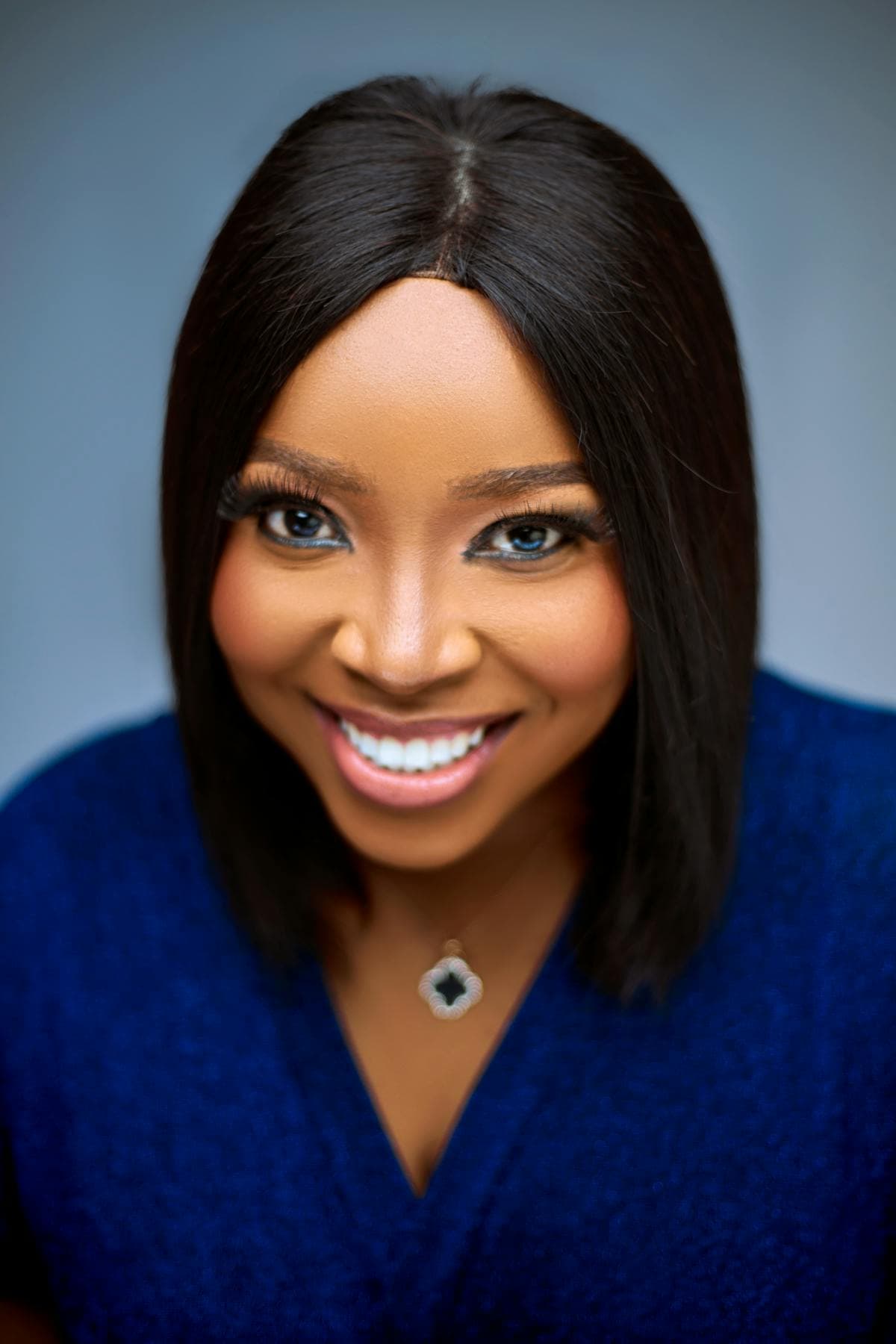 Adult clear aligner case — 14 months to a perfect smile