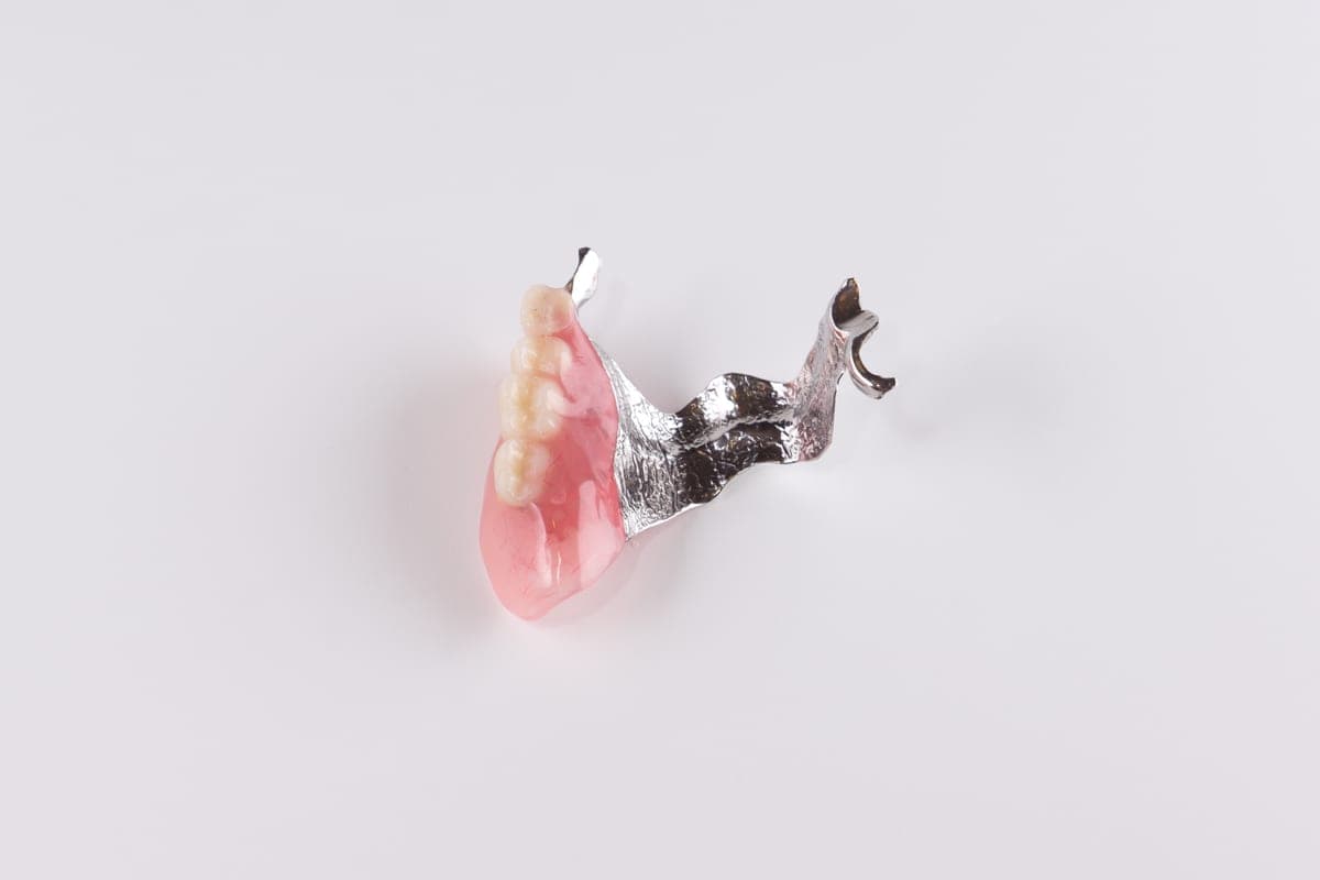 Partial Dentures