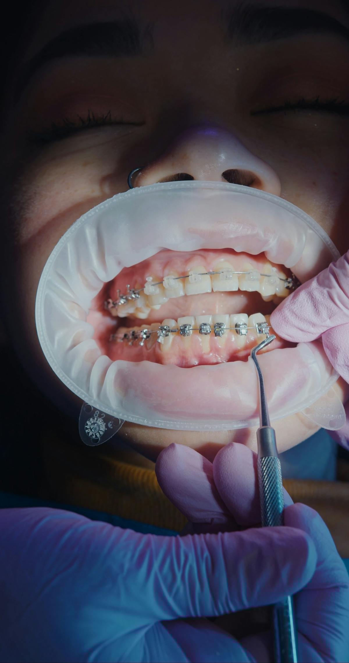 Your Orthodontic Journey — From Consultation to Beautiful Smile